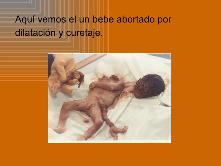 Power Point Aborto