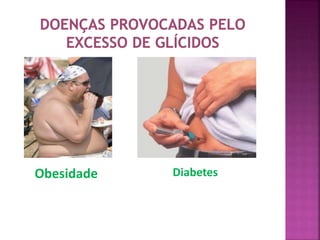Obesidade Diabetes 
 