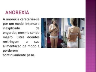 A anorexia carateriza-se 
por um medo intenso e 
inexplicado de 
engordar, mesmo sendo 
magro. Estes doentes 
restringem a sua 
alimentação de modo a 
perderem 
continuamente peso. 
 