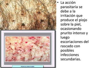• La acción
  parasitaria se
  debe a la
  irritación que
  produce el piojo
  sobre la piel,
  ocasionando
  prurito intenso y
  luego
  escoriaciones del
  rascado con
  posibles
  infecciones
  secundarias.
 