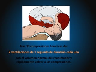 Tras 30 compresiones torácicas dar
2 ventilaciones de 1 segundo de duración cada una
con el volumen normal del reanimador y
rápidamente volver a las compresiones.
 