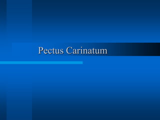 Pectus Carinatum
 