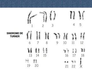 Power de 2° medio material genetico