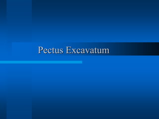 Pectus Excavatum
 