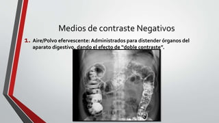 Medios de contraste Negativos
1. Aire/Polvo efervescente: Administrados para distender órganos del
aparato digestivo, dando el efecto de “doble contraste”.
 