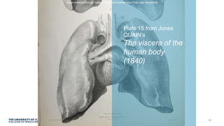Plate 15 from Jones
QUAIN’s
The viscera of the
human body
(1840)
Image obtained through Creative Commons License from Flickr user liverpoolhls
16
 