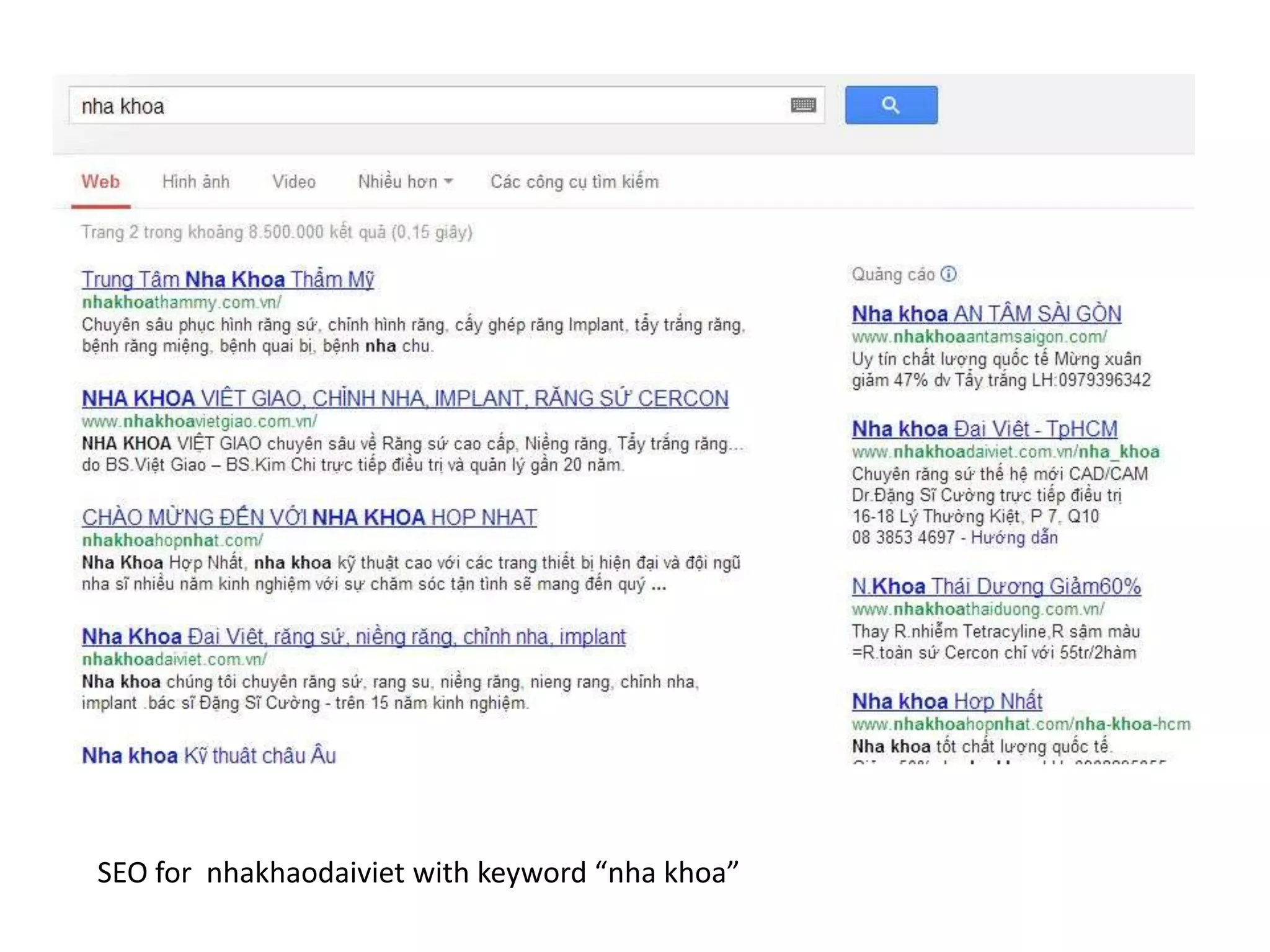 SEO for nhakhaodaiviet with keyword “nha khoa”
 