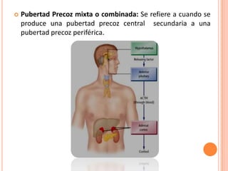    Pubertad Precoz mixta o combinada: Se refiere a cuando se
    produce una pubertad precoz central secundaria a una
    pubertad precoz periférica.
 
