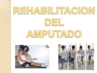 INTRODUCCION
La rehabilitación de un paciente amputado debe
realizarse por un equipo multidisciplinar.
El medico rehabilit...