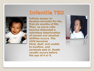 Tay-Sachs Disease