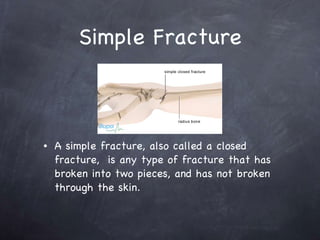 Math Simple Fracture Comminuted, Simple, and Compound Fractures | PPT