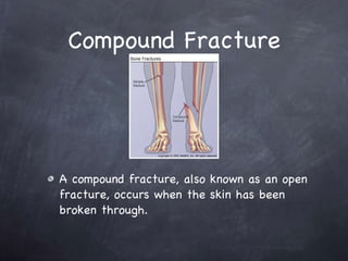 Comminuted Simple And Compound Fractures