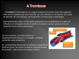 A Trombose   A Trombose é a formação de um coágulo sanguíneo (tromba) numa veia sanguínea. Pode ocorrer quando uma veia é atacada  por uma infecção ou um trauma. Se a causa da agressão  for uma bactéria, eventualmente a tromba pode se desintegrar. Alternativamente, toda a tromba pode desprender-se, principalmente na origem da infecção e ser carregada através do sistema circulatório  até que alcance uma veia sanguínea muito estreita para passar. Fluxo sanguíneoVálvula Se isso acontecer, a tromba prende-se e instantaneamente bloqueia a circulação , um factor conhecido como embolismo.As  consequências clínicas de um embolismo depende de onde ele ocorre. Se ocorrer na artéria coronária (artéria do coração) , pode ocorrer um ataque cardíaco. Coágulo sanguíneo