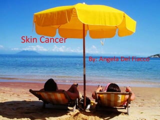 Skin Cancer
By: Angela Del Fiacco
 