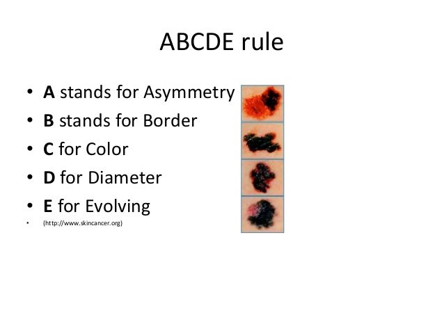 cancer treatment d skin vitamin Cancer Skin