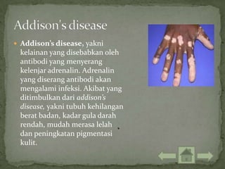 Addison’s disease, yakni
 kelainan yang disebabkan oleh
 antibodi yang menyerang
 kelenjar adrenalin. Adrenalin
 yang diserang antibodi akan
 mengalami infeksi. Akibat yang
 ditimbulkan dari addison’s
 disease, yakni tubuh kehilangan
 berat badan, kadar gula darah
 rendah, mudah merasa lelah
 dan peningkatan pigmentasi
 kulit.
 