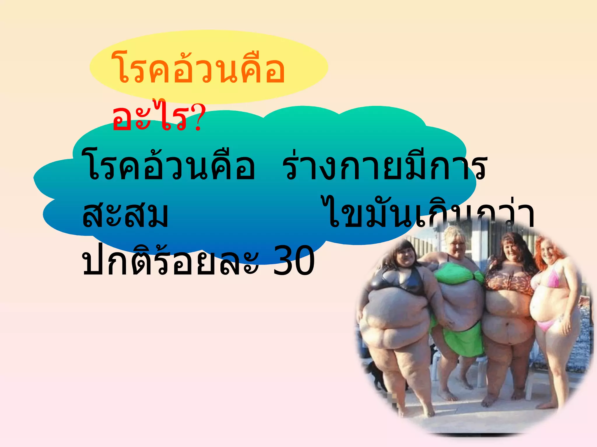 โรคอ้วนคือ  ร่างกายมีการสะสม  ไขมันเกินกว่าปกติร้อยละ  30 โรคอ้วนคืออะไร ? 