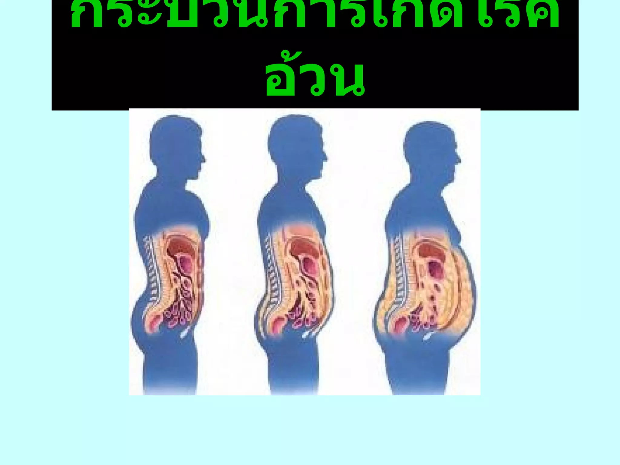 กระบวนการเกิดโรคอ้วน 