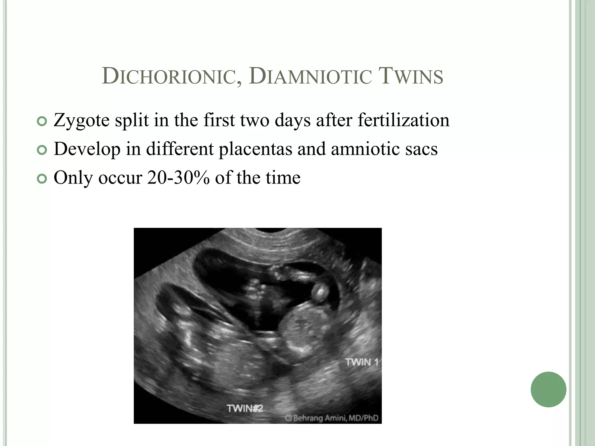 DICHORIONIC, DIAMNIOTIC TWINS
 Zygote split in the first two days after fertilization
 Develop in different placentas and amniotic sacs
 Only occur 20-30% of the time
 