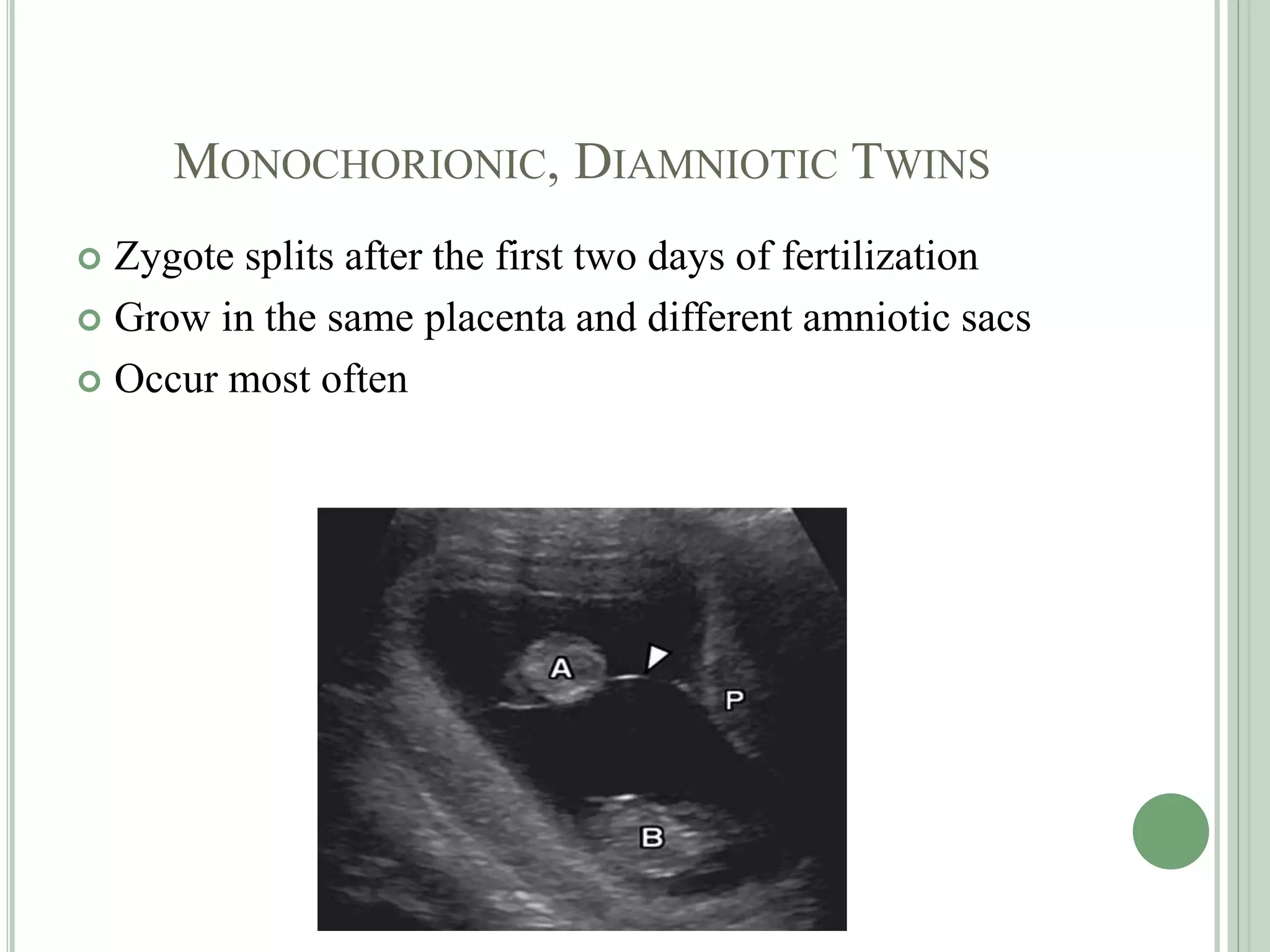 MONOCHORIONIC, DIAMNIOTIC TWINS
 Zygote splits after the first two days of fertilization
 Grow in the same placenta and different amniotic sacs
 Occur most often
 
