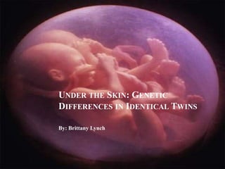 UNDER THE SKIN: GENETIC
DIFFERENCES IN IDENTICAL TWINS
By: Brittany Lynch
 