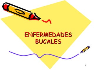 ENFERMEDADES
   BUCALES


               1
 