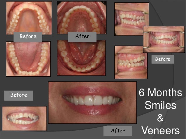 Orlando FL Dentist, Alafaya Center For Cosmetic & Family ... Orlando FL Dentist, Alafaya Center For Cosmetic & Family ...