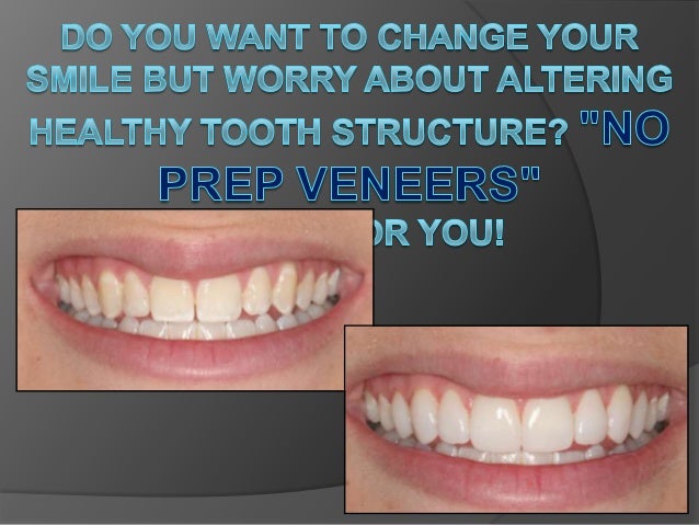 Orlando FL Dentist, Alafaya Center For Cosmetic & Family ... Orlando FL Dentist, Alafaya Center For Cosmetic & Family ...