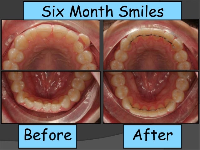 Orlando FL Dentist, Alafaya Center For Cosmetic & Family ... Orlando FL Dentist, Alafaya Center For Cosmetic & Family ...