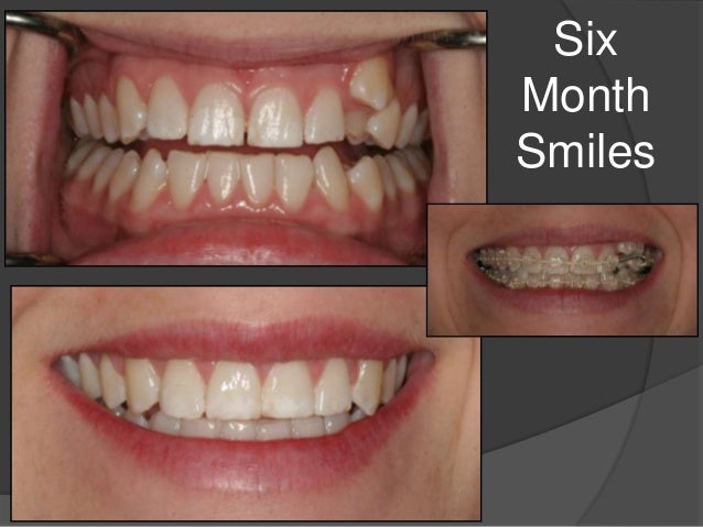 Orlando FL Dentist, Alafaya Center For Cosmetic & Family ... Orlando FL Dentist, Alafaya Center For Cosmetic & Family ...