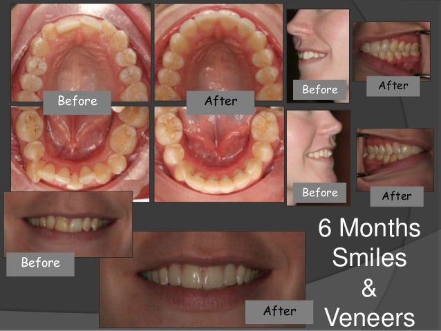 Orlando FL Dentist, Alafaya Center For Cosmetic & Family ... Orlando FL Dentist, Alafaya Center For Cosmetic & Family ...