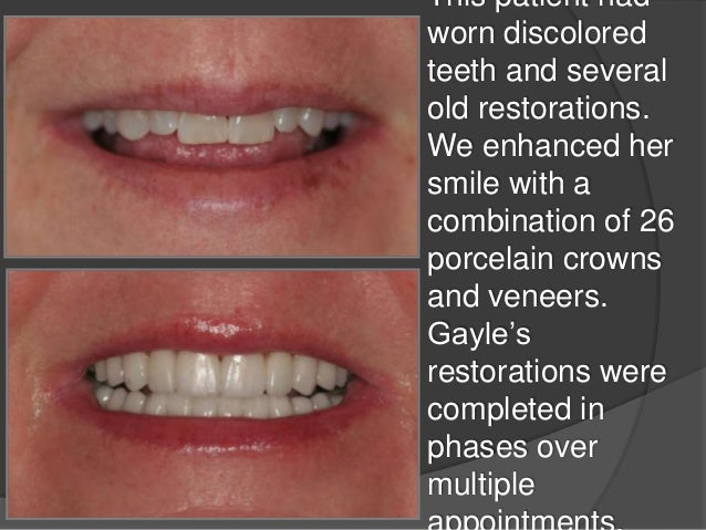 Orlando FL Dentist, Alafaya Center For Cosmetic & Family ... Orlando FL Dentist, Alafaya Center For Cosmetic & Family ...
