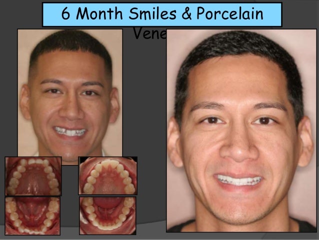 Orlando FL Dentist, Alafaya Center For Cosmetic & Family ... Orlando FL Dentist, Alafaya Center For Cosmetic & Family ...