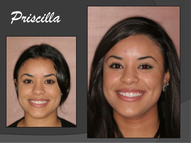 Orlando FL Dentist, Alafaya Center For Cosmetic & Family ... Orlando FL Dentist, Alafaya Center For Cosmetic & Family ...