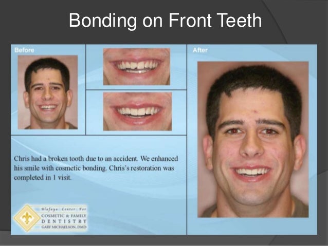 Orlando FL Dentist, Alafaya Center For Cosmetic & Family ... Orlando FL Dentist, Alafaya Center For Cosmetic & Family ...