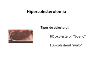 Tipos de colesterol: 
HDL-colesterol “bueno” 
LDL-colesterol “malo” 
 