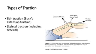 indication and contra-indication cast & traction