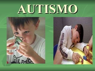AUTISMO 