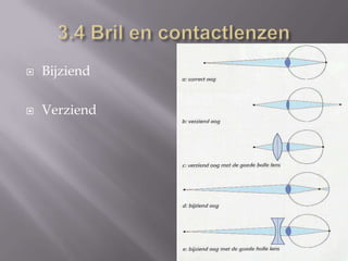 3.4 Bril en contactlenzenBijziendVerziend