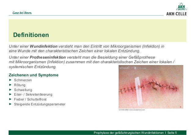 Americas Dirtiest Cities Travel  Leisure