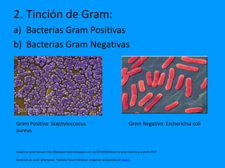 2. Tinción de Gram:
a) Bacterias Gram Positivas
b) Bacterias Gram Negativas




Gram Positivo: Staphyloccocus                                                         Gram Negativo: Escherichia coli
aureus


Imágenes obtenidas de http://biologiamedica.blogspot.com.ar/2010/09/bacterias-gram-positivas-y-gram.html

Derechos de autor @Jampieer. Plantilla Picture Window. Imágenes de plantillas de Raycat.
 