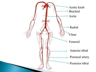 Aortic knob 
Brachial 
Aorta 
Radial 
Ulnar 
Femoral 
Anterior tibial 
Peroneal artery 
Posterior tibial 
 