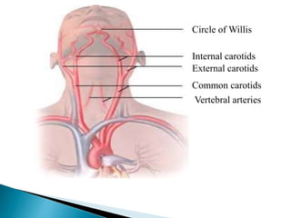 Circle of Willis 
Internal carotids 
External carotids 
Common carotids 
Vertebral arteries 
 
