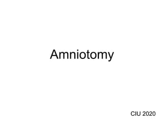Amniotomy
CIU 2020
 