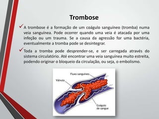 Trombose
A trombose é a formação de um coágulo sanguíneo (tromba) numa
veia sanguínea. Pode ocorrer quando uma veia é atacada por uma
infeção ou um trauma. Se a causa da agressão for uma bactéria,
eventualmente a tromba pode se desintegrar.
Toda a tromba pode desprender-se, e ser carregada através do
sistema circulatório. Até encontrar uma veia sanguínea muito estreita,
podendo originar o bloqueio da circulação, ou seja, o embolismo.
 