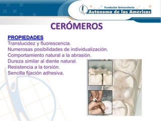 CERÓMEROS
PROPIEDADES
Translucidez y fluorescencia.
Numerosas posibilidades de individualización.
Comportamiento natural a la abrasión.
Dureza similar al diente natural.
Resistencia a la torsión.
Sencilla fijación adhesiva.
 