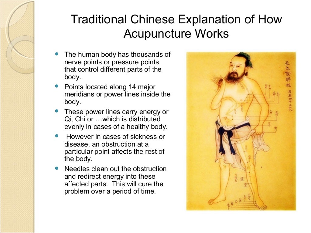 Powerpoint acupuncture works