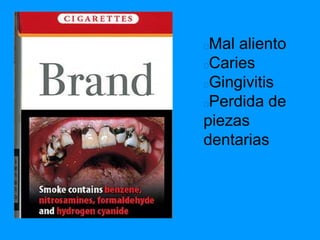 Mal aliento
Caries
Gingivitis
Perdida de
piezas
dentarias
 