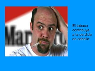 El tabaco
contribuye
a la perdida
de cabello
 