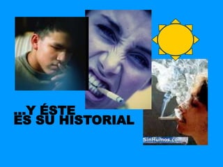 ...Y ÉSTE
ES SU HISTORIAL
 